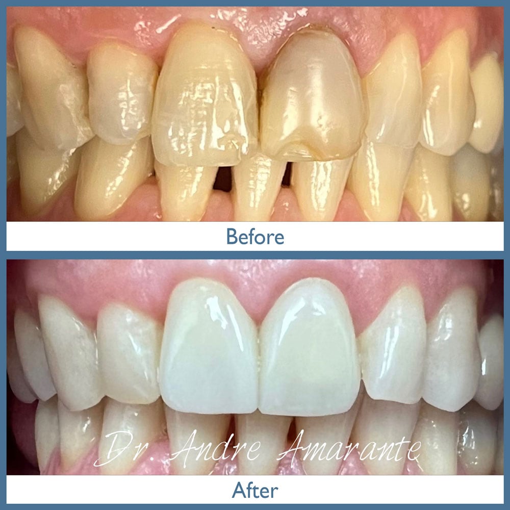 Way Dental Before and After in Evanston, IL