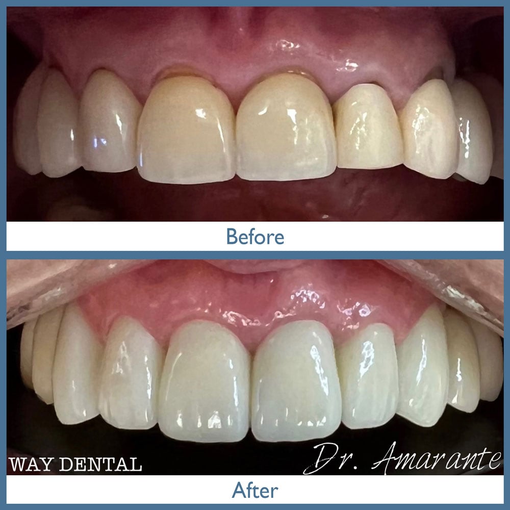 Way Dental Before and After in Evanston, IL