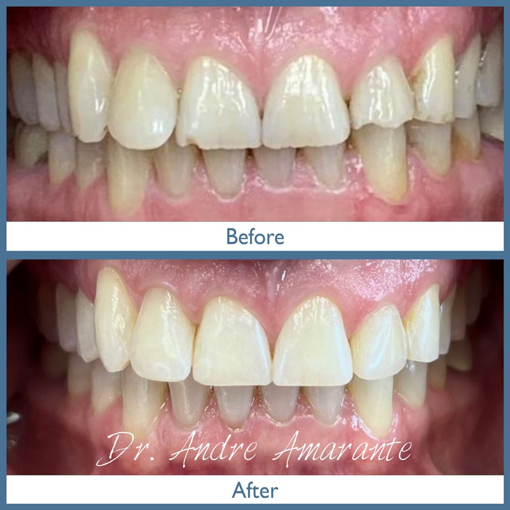 Way Dental Before and After in Evanston, IL