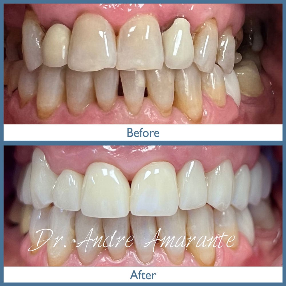 Way Dental Before and After in Evanston, IL