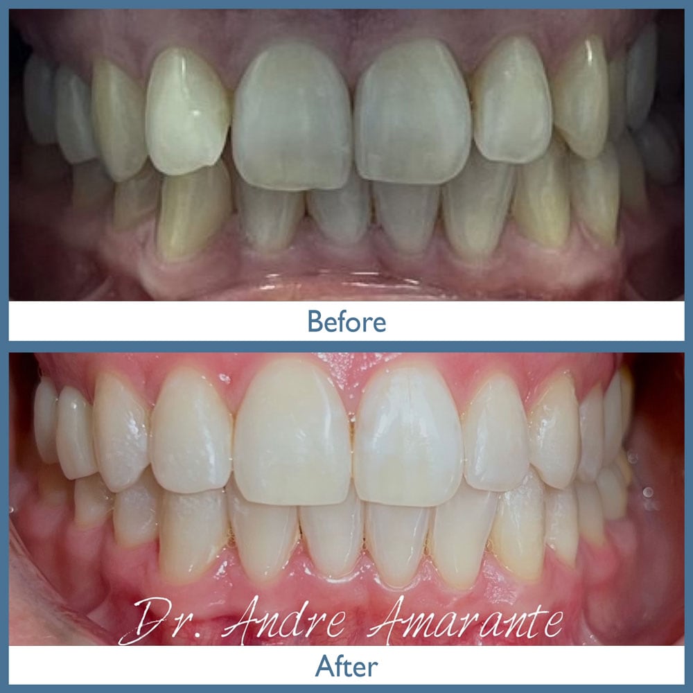 Way Dental Before and After in Evanston, IL