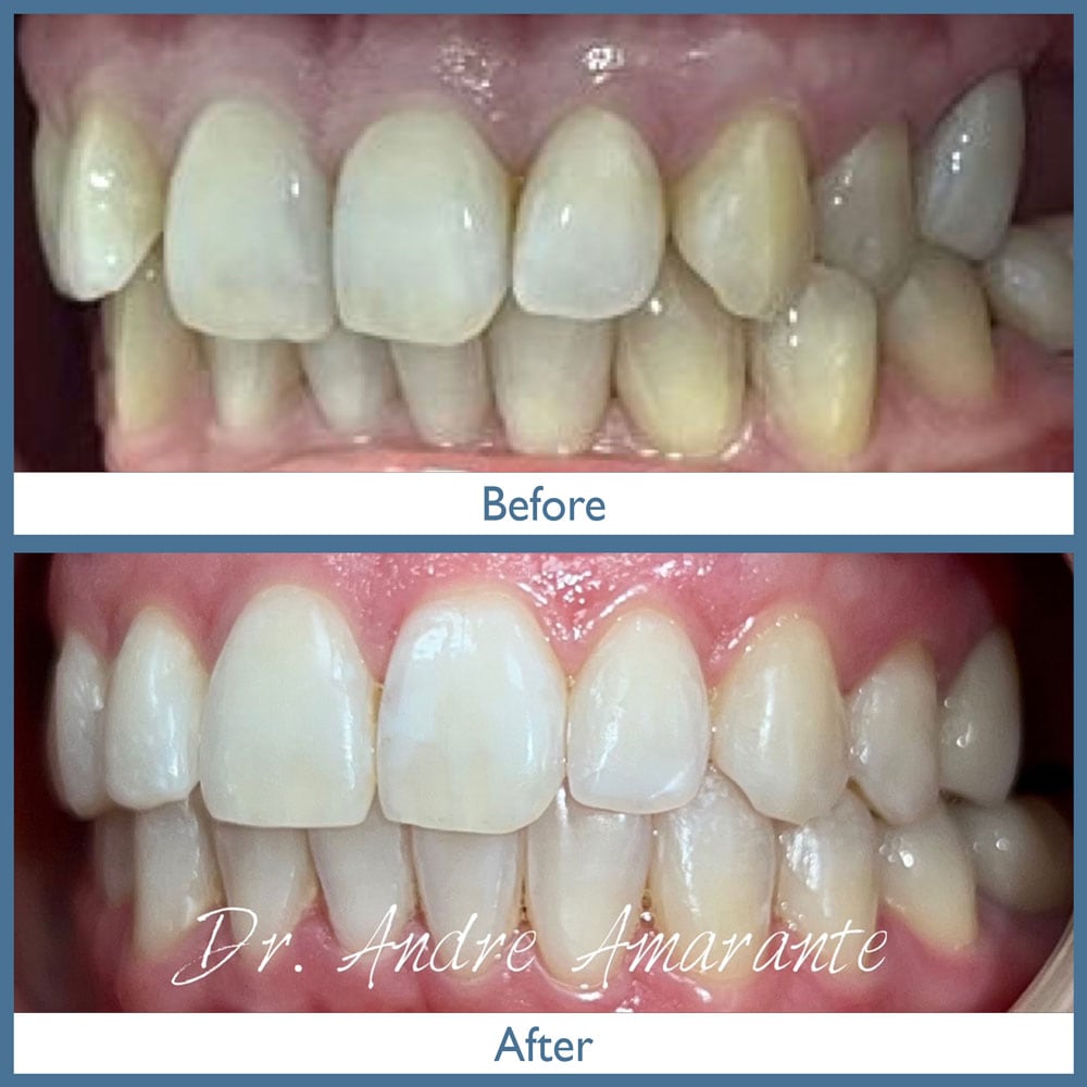 Way Dental Before and After in Evanston, IL