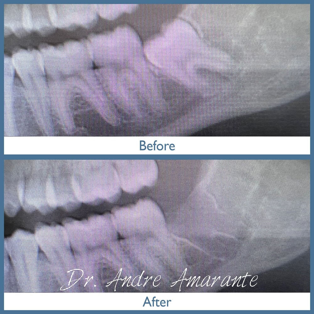 Way Dental Before and After in Evanston, IL