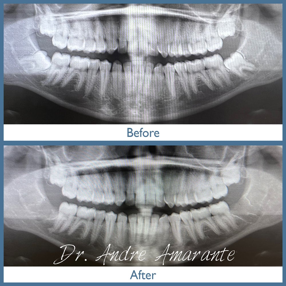 Way Dental Before and After in Evanston, IL