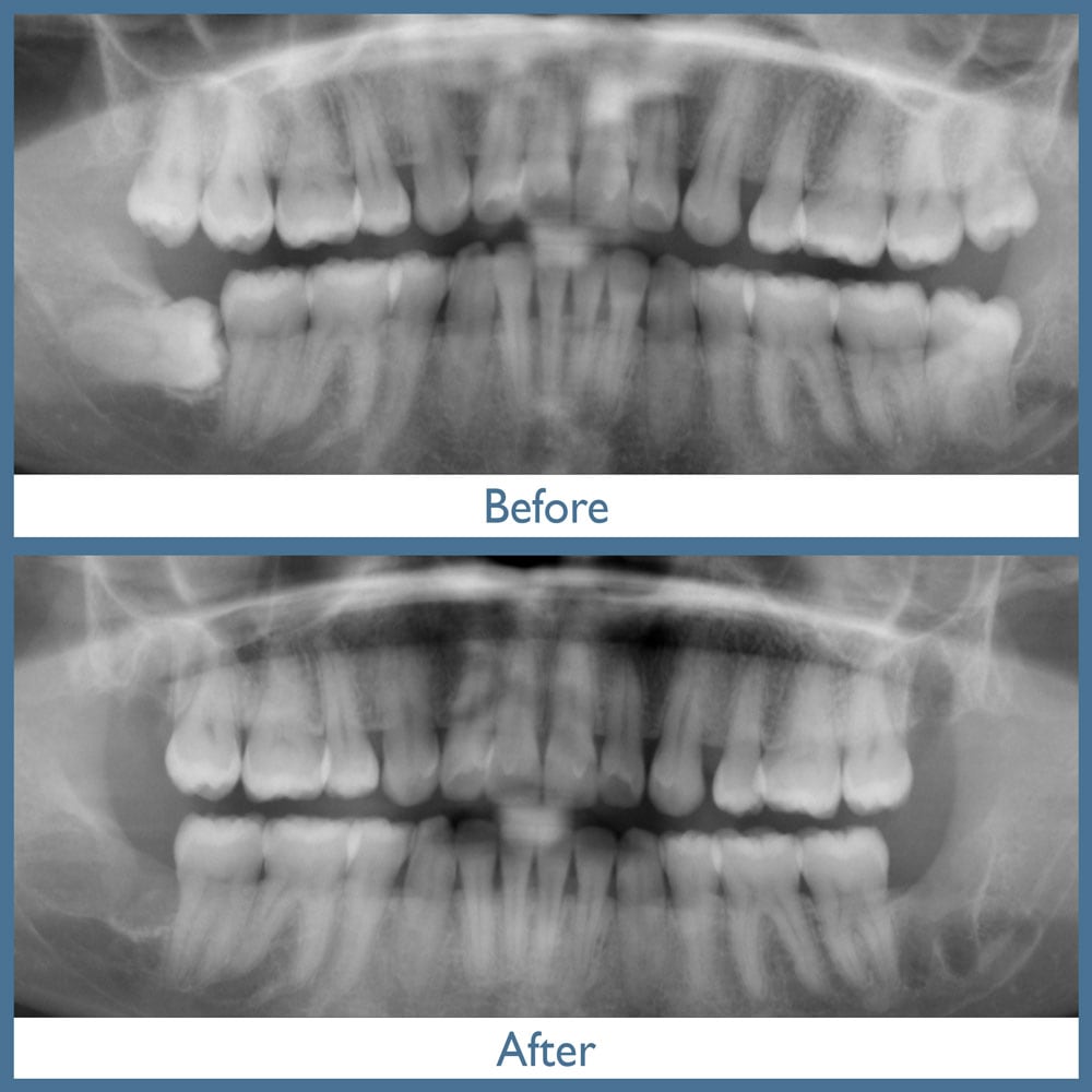 Way Dental Before and After in Evanston, IL