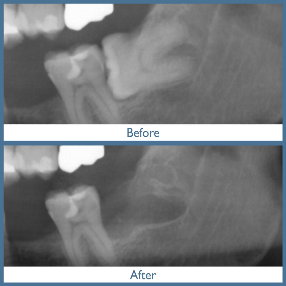 Way Dental Before and After in Evanston, IL