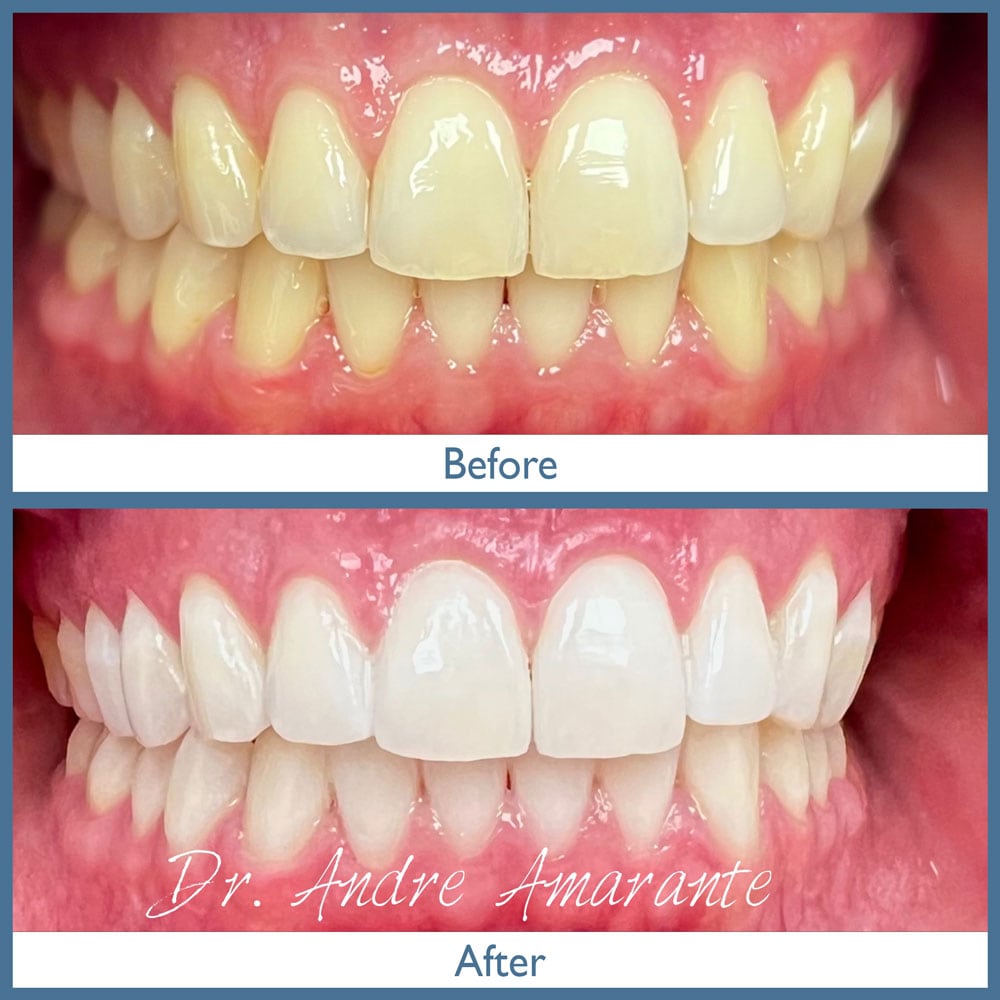 Way Dental Before and After in Evanston, IL