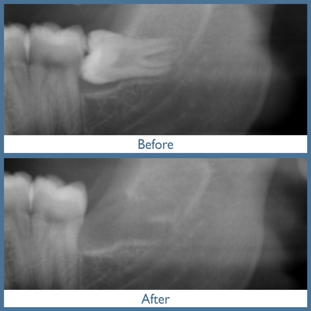 Way Dental Before and After in Evanston, IL