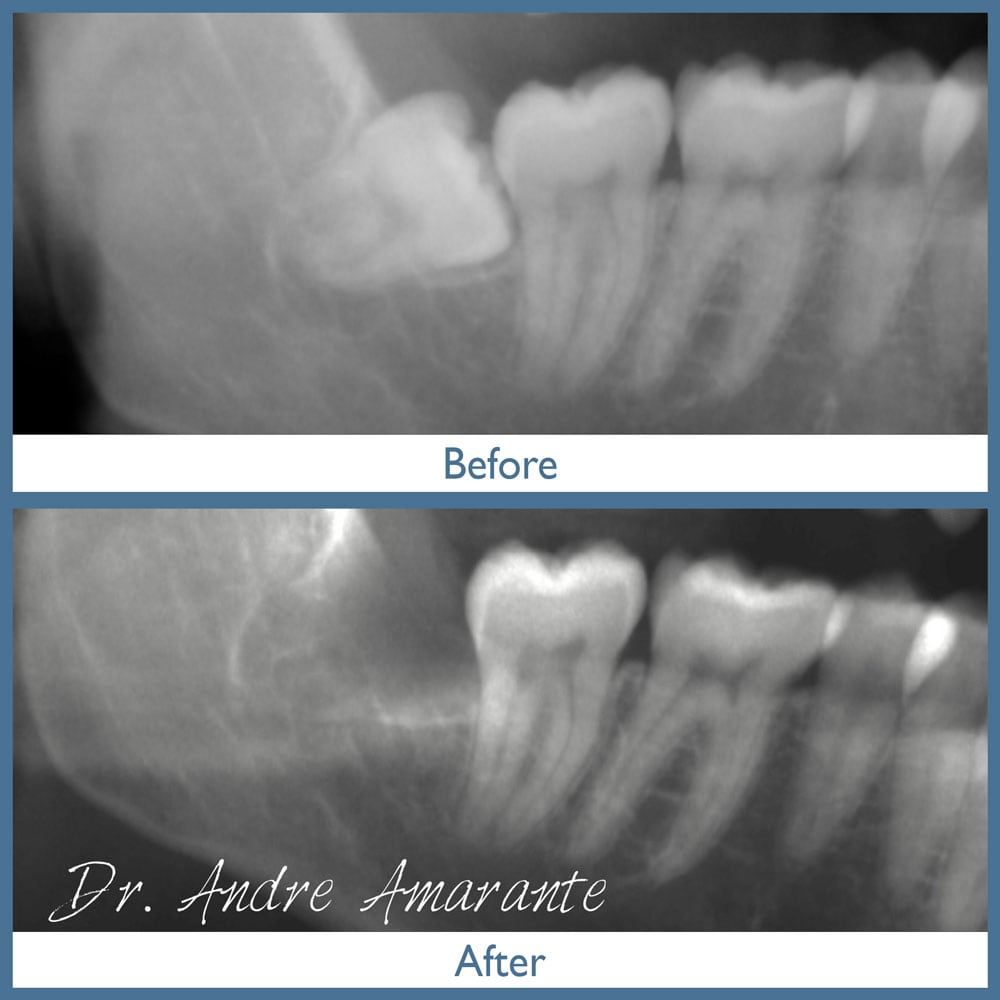 Way Dental Before and After in Evanston, IL