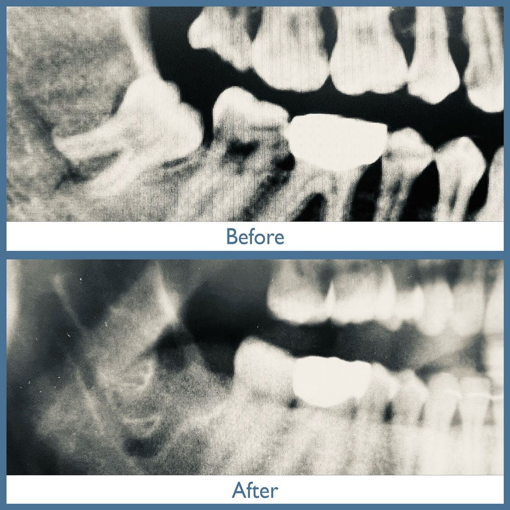 Way Dental Before and After in Evanston, IL