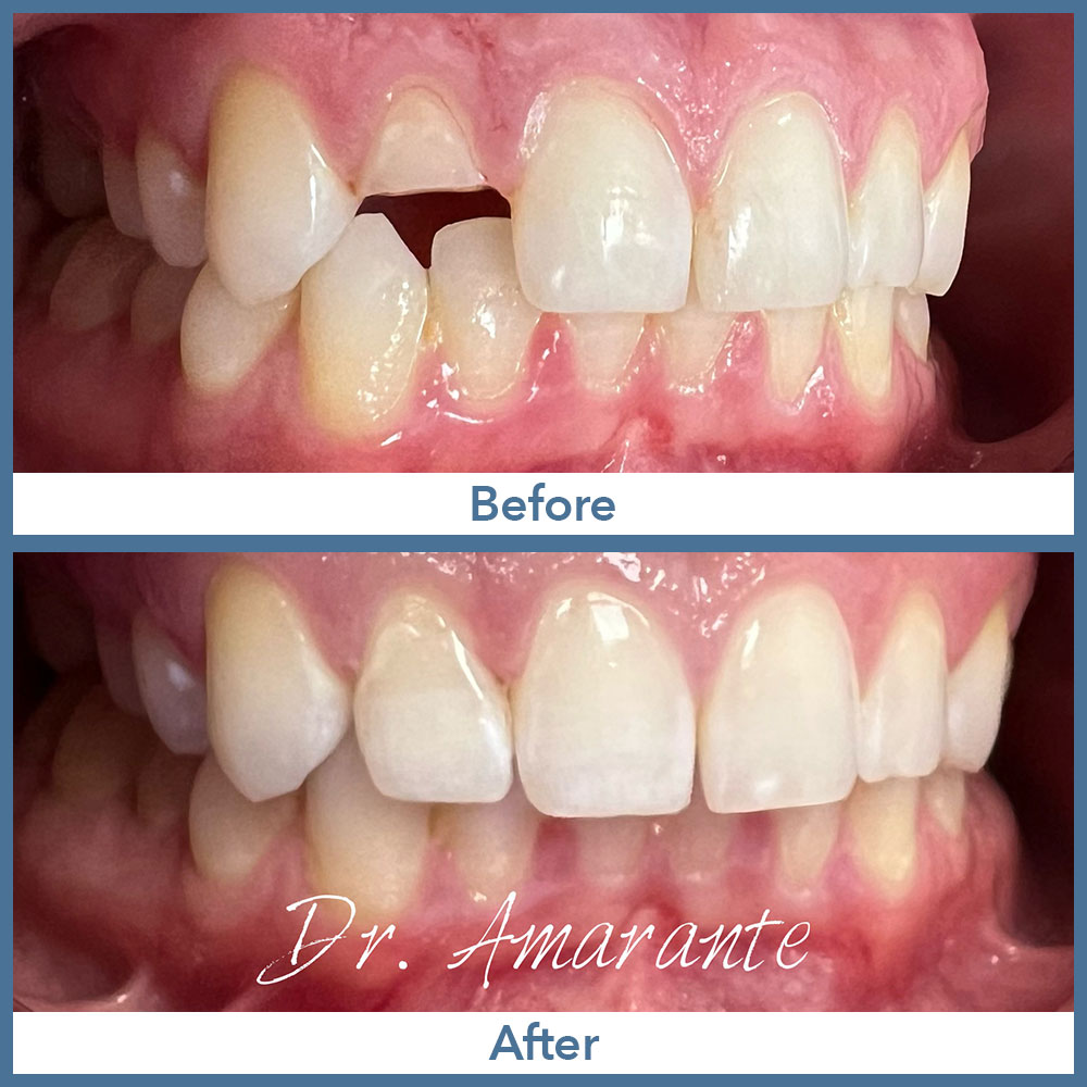 Way Dental Before and After in Evanston, IL