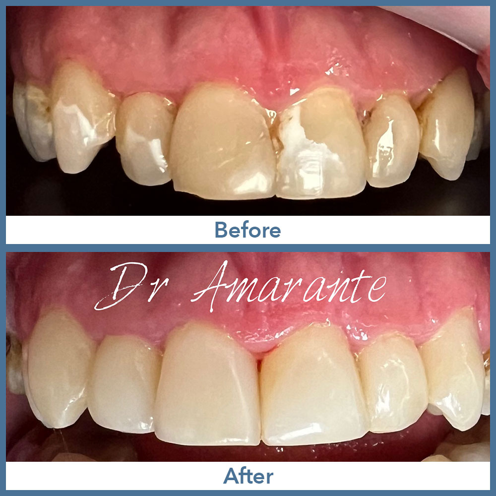 Way Dental Before and After in Evanston, IL