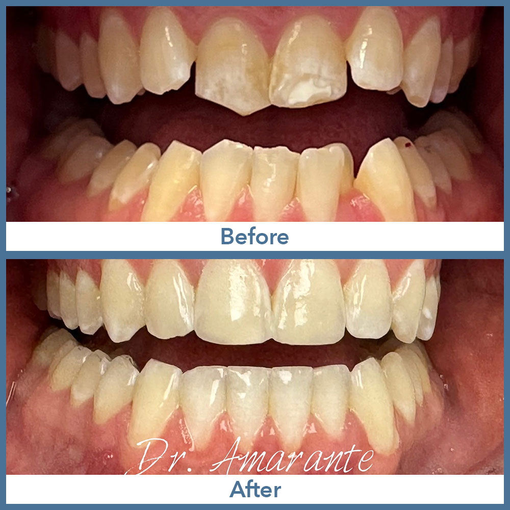 Way Dental Before and After in Evanston, IL