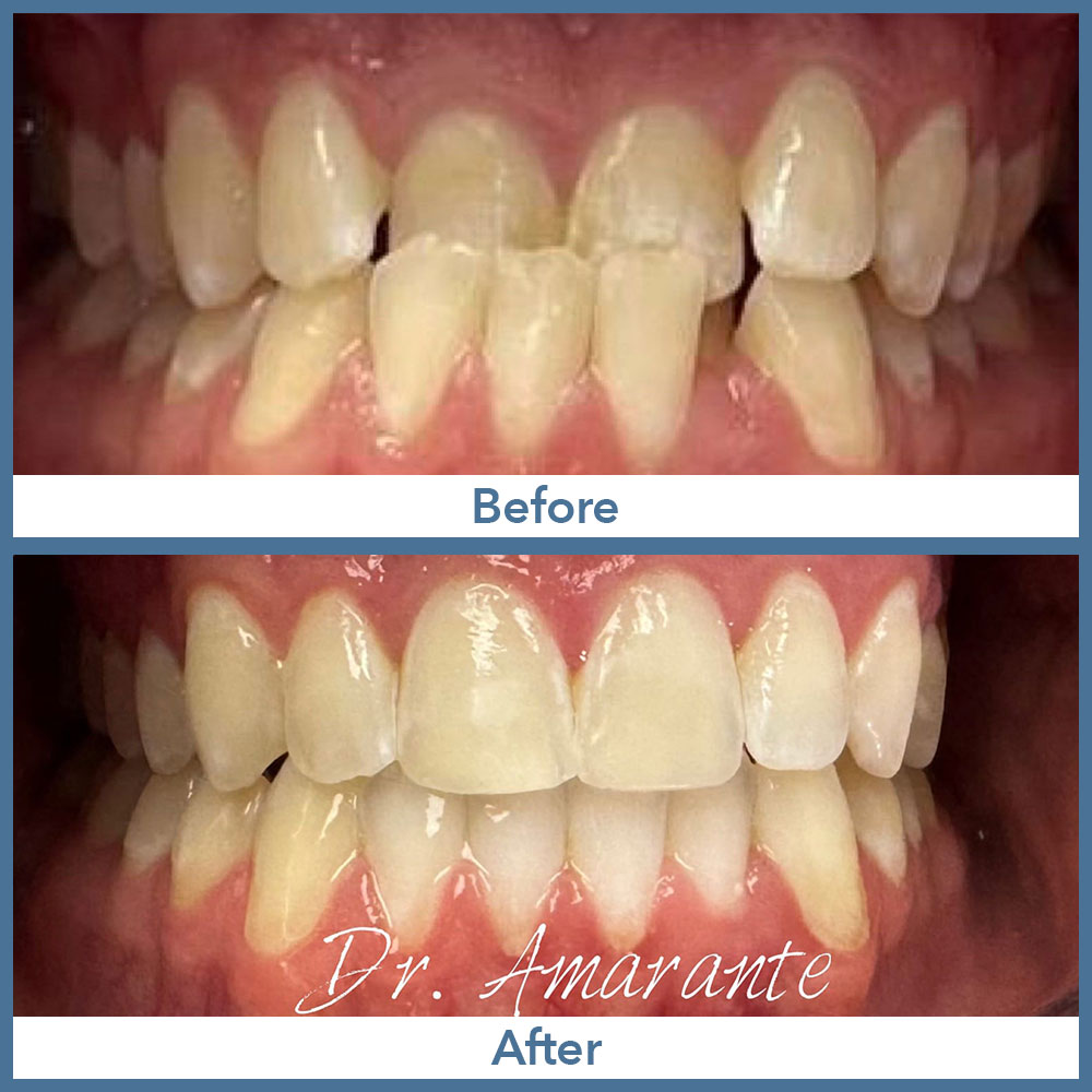 Way Dental Before and After in Evanston, IL