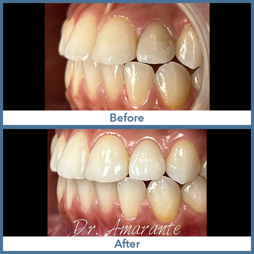 Way Dental Before and After in Evanston, IL