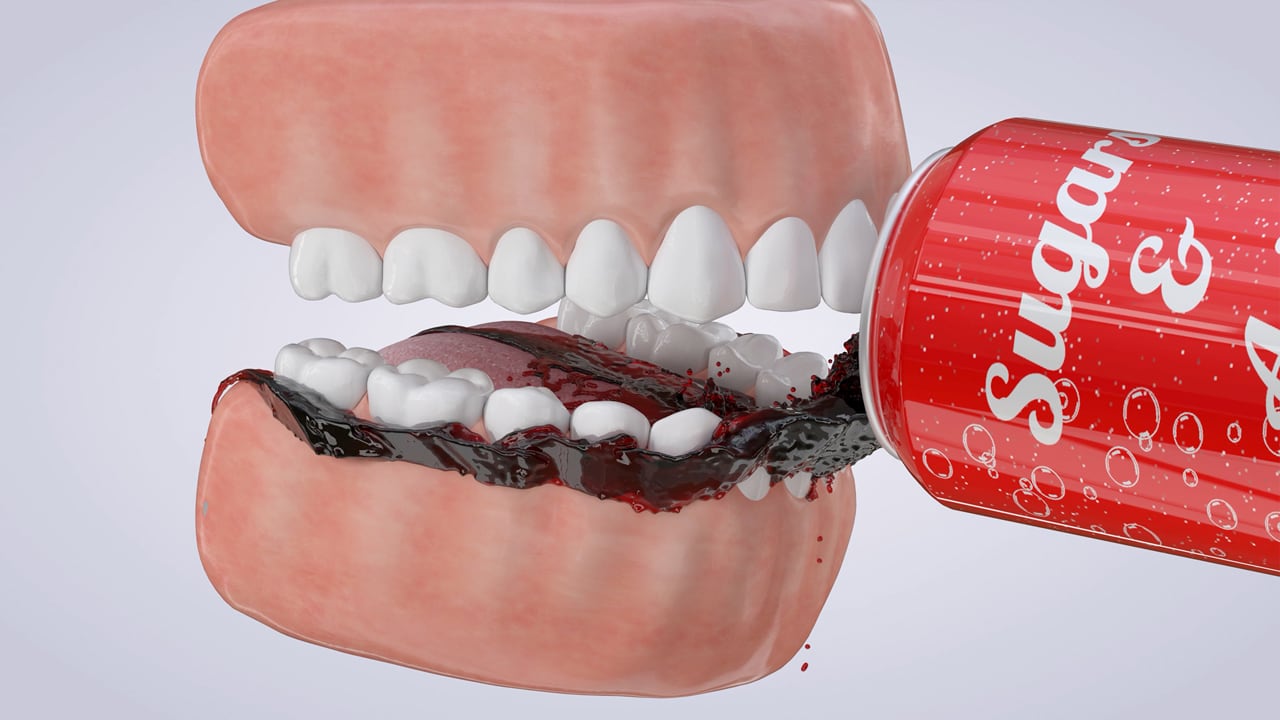 Poster image for the Nutrition & Your Teeth patient-education video