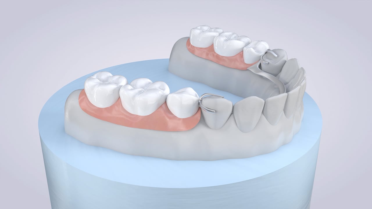 Poster image for the Partial Dentures patient-education video