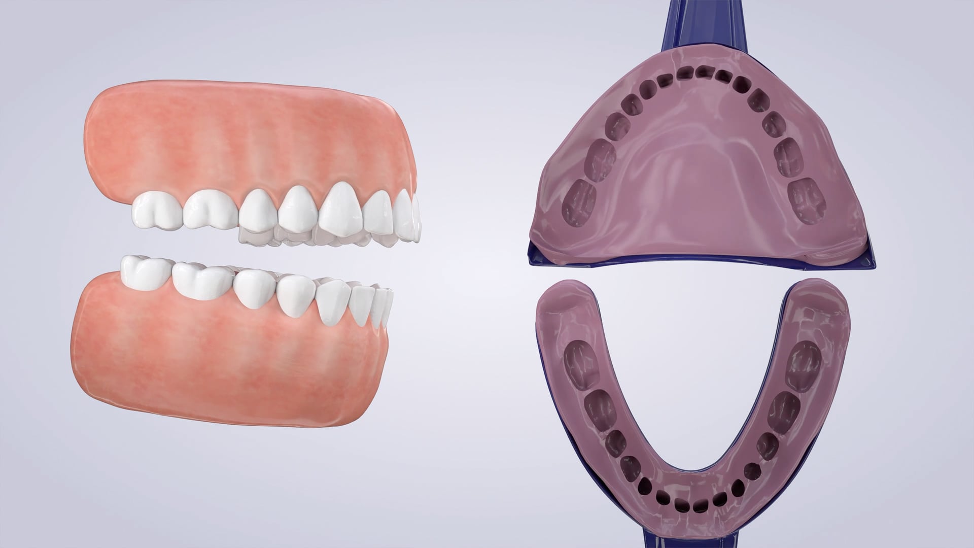 Poster image for the Take-Home Teeth Whitening patient-education video