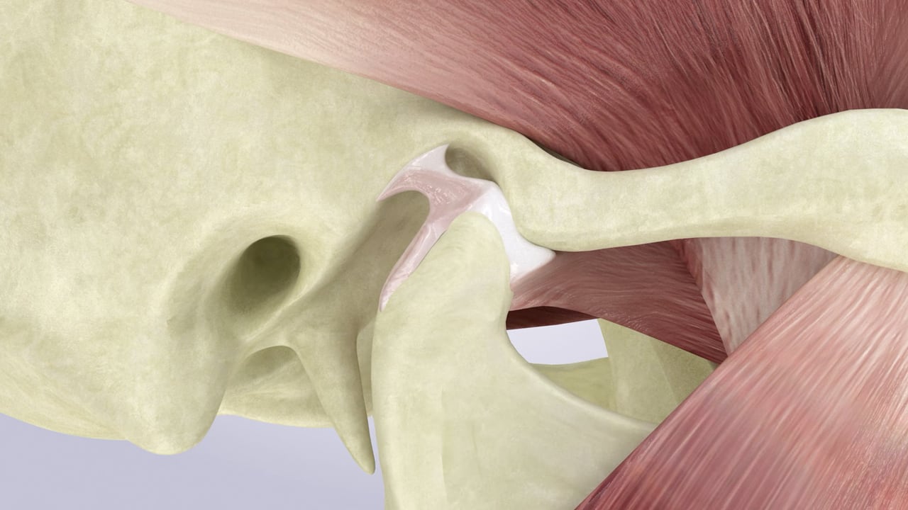Poster image for the TMJ & TMD patient-education video